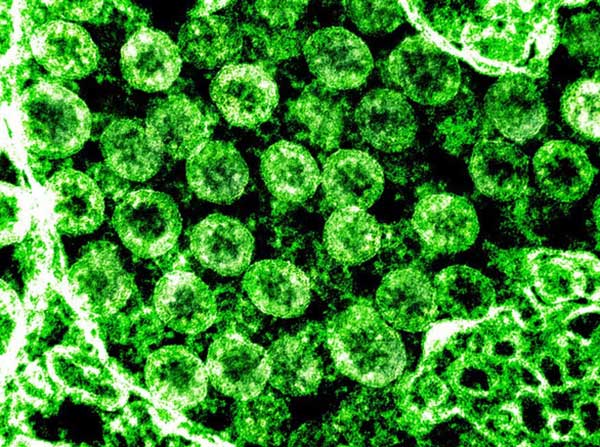 Phân tử virus cornoa phân lập - Ảnh: NIAID-RM